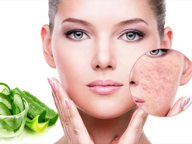 Cách trị sẹo rỗ trên mặt lâu năm tại nhà hiệu quả nhanh nhất - 12