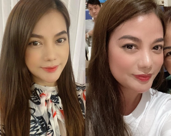 Càng nhìn càng thấy gương mặt khác lạ trương ngọc ánh vướng nghi vấn phẫu thuật thẩm mỹ - 5