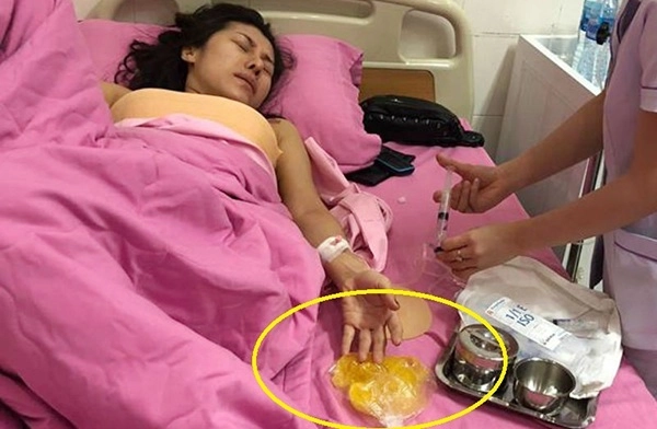 Chi tiền đi nâng ngực người phải cắt bỏ cả vòng 1 người sống thực vật đến hết đời - 3