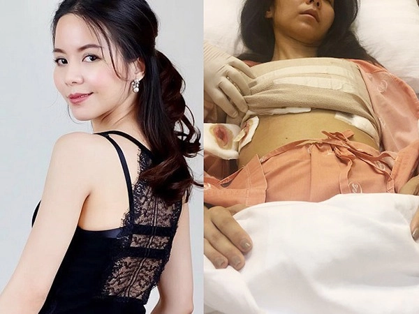 Chi tiền đi nâng ngực người phải cắt bỏ cả vòng 1 người sống thực vật đến hết đời - 6