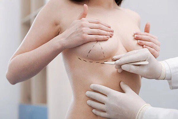 Chi tiền đi nâng ngực người phải cắt bỏ cả vòng 1 người sống thực vật đến hết đời - 8