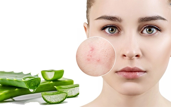 Nha đam có tác dụng gì với làm đẹp da mặt và dưỡng tóc - 2