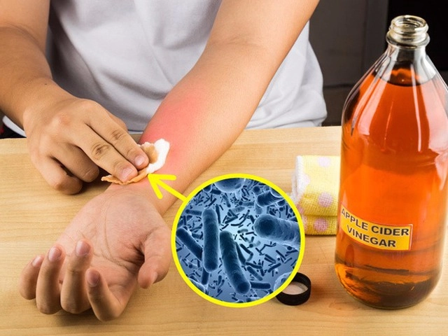 Bạn đã biết cách chăm sóc da khi mùa mưa kéo dài liên tục chưa - 5