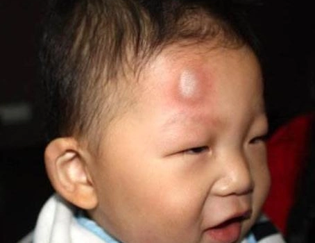 Bé 1 tuổi ngã trên giường xuống thái độ của mẹ làm bà nội khó chịu bác sĩ lại khen - 1
