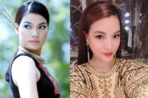 Cằm dài ngoằng mặt cứng đơ phải chăng trương ngọc ánh gặp biến chứng khi phẫu thuật thẩm mỹ - 5