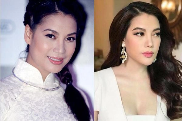 Cằm dài ngoằng mặt cứng đơ phải chăng trương ngọc ánh gặp biến chứng khi phẫu thuật thẩm mỹ - 6