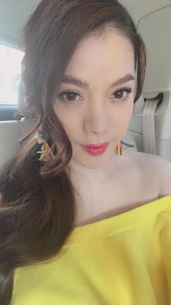 Cằm dài ngoằng mặt cứng đơ phải chăng trương ngọc ánh gặp biến chứng khi phẫu thuật thẩm mỹ - 12