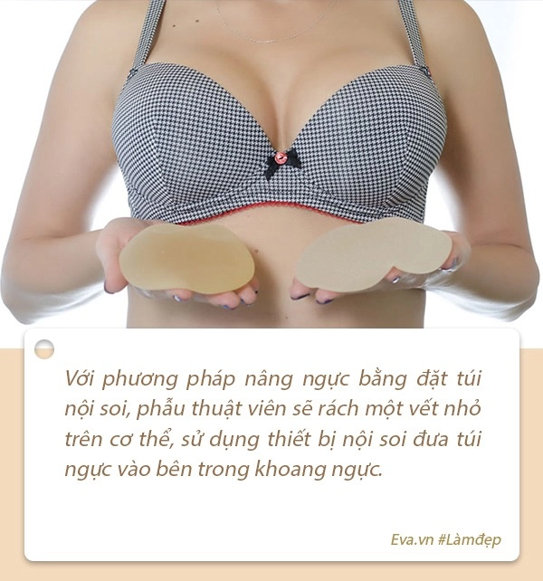 Cứ nắm rõ những điều sau nàng sẽ có quyết định phẫu thuật nâng cấp vòng 1 đúng đắn nhất - 4