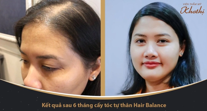 Giải pháp cấp cứu hiệu quả cho mái tóc thưa mỏng của chị em - 4
