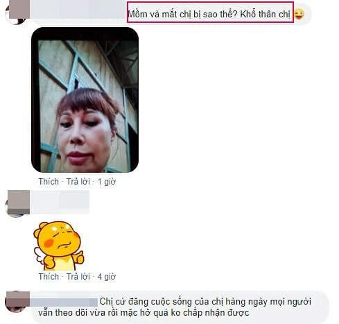 Khoe ảnh đẹp tưởng được khen cô dâu 62 tuổi bị soi nhan sắc sau 1 tháng phẫu thuật - 3