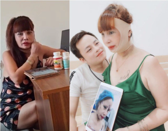 Khoe ảnh đẹp tưởng được khen cô dâu 62 tuổi bị soi nhan sắc sau 1 tháng phẫu thuật - 7