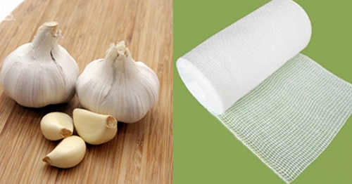 Mách bạn công thức tẩy nốt ruồi tại nhà với tỏi khô - 2