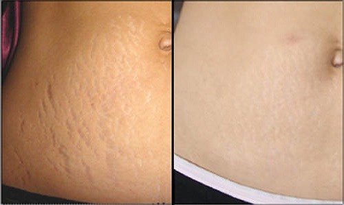 Mẹ sau sinh siêng tắm loại nước làm từ nghệ da mịn màng trắng lên trông thấy - 2