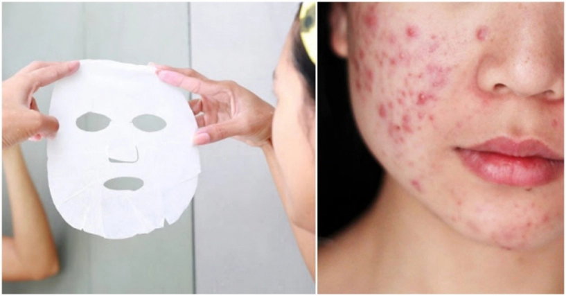 Nàng ngoài 30 chớ mua các loại mặt nạ trôi nổi không rõ nguồn gốc kẻo lại toang làn da - 4