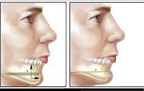 Nhờ thay đổi chi tiết này trên khuôn mặt mà sao việt phất lên như diều gặp gió - 9