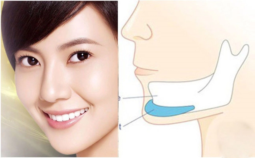 Nhờ thay đổi chi tiết này trên khuôn mặt mà sao việt phất lên như diều gặp gió - 10