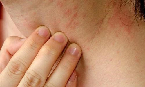 Nước hoa fake gắn mác hàng chính hãng và những hiểm họa khôn lường - 3