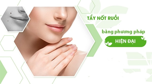 Tẩy nốt ruồi tại nhà và những lưu ý cần biết để tránh hậu quả khôn lường - 2