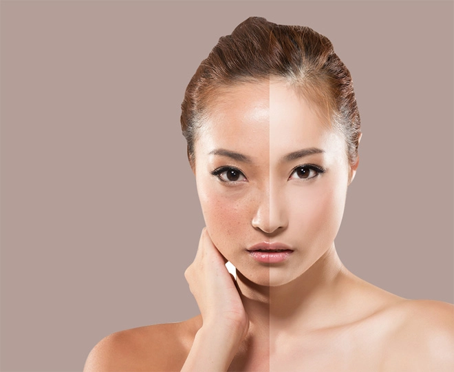 Thiệt hại không phanh vì trắng da cấp tốc - 2