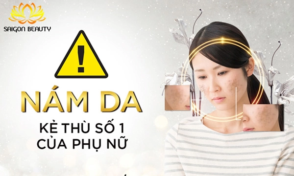 Trị nám tàn nhang uy tín tại tmv saigon beauty - 1