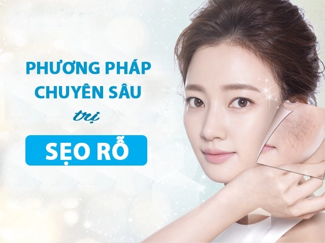 Tuyệt đối không được làm những điều sau da mặt sẽ xấu đi vì sẹo rỗ - 5