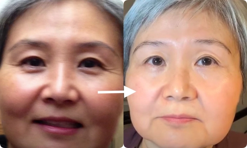 60 tuổi da vẫn nhẵn thín không gợn nếp nhăn cụ bà bật mí đây là chân ái - 5