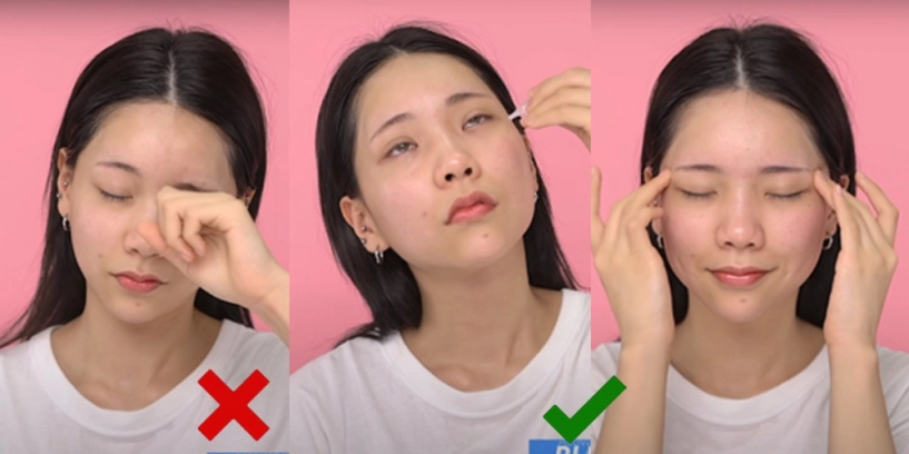 Bị quầng thâm mắt bấy lâu nhưng bạn đã biết mình thuộc loại thâm gì chưa - 3