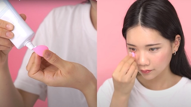 Bị quầng thâm mắt bấy lâu nhưng bạn đã biết mình thuộc loại thâm gì chưa - 5