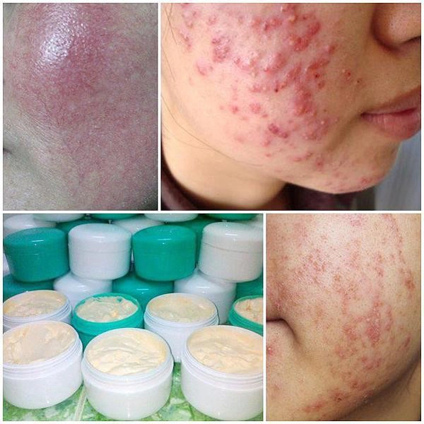 Bo shop khuyên bạn nên dùng mỹ phẩm chính hãng tránh xa kem trộn - 1