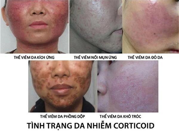 Bo shop khuyên bạn nên dùng mỹ phẩm chính hãng tránh xa kem trộn - 2