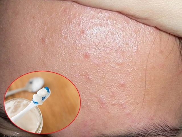 Da mặt láng o không tì vết với 4 cách trị tàn nhang bằng nha đam - 6