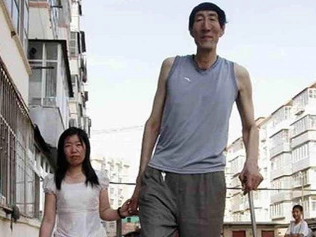 Em bé thụ tinh ống nghiệm kỳ diệu 32 năm trước giờ trưởng thành nhiều người thất vọng - 6