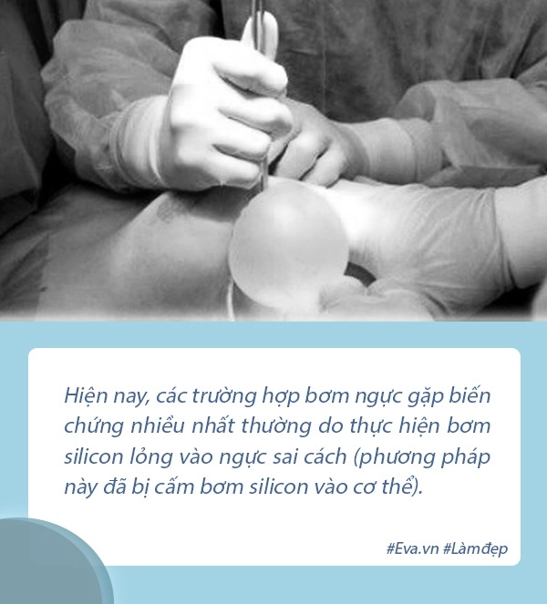 Giải đáp loạt thắc mắc về phương pháp bơm ngực ai định nâng cấp vòng 1 chớ bỏ qua - 5