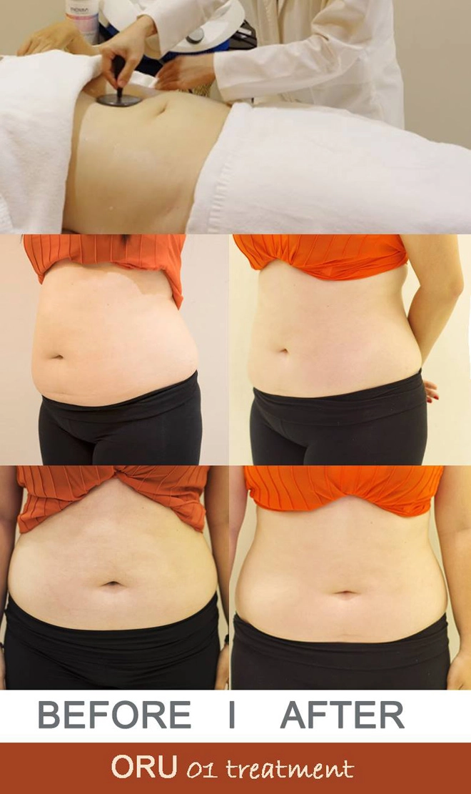 Hiệu quả giảm mỡ thừa tăng gấp bội nhờ áp dụng giải pháp này - 1