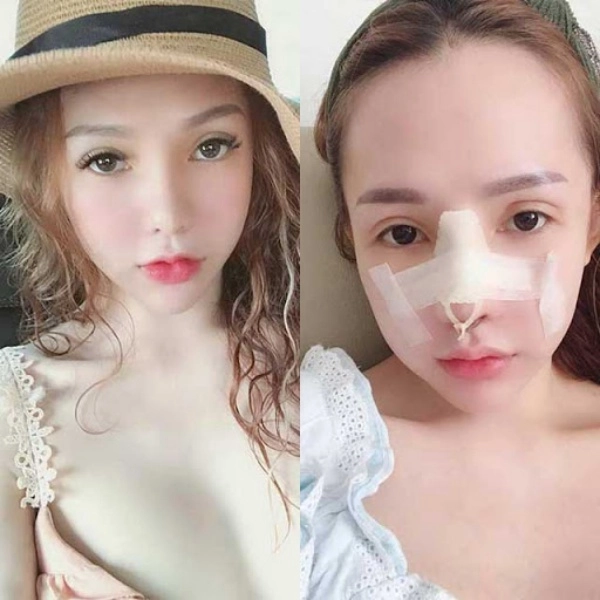 Lột xác sau thẩm mỹ 9x được bạn trai cũ ngỏ ý muốn quay lại - 2