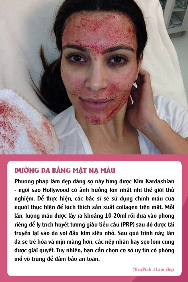 Phương pháp làm đẹp độc lạ vẫn được chị em áp dụng đắp mask phân chim dùng đỉa hút mụn - 6