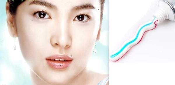 Tẩy nốt ruồi tại nhà và những lưu ý cần biết để tránh hậu quả khôn lường - 4