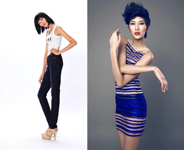 Vướng nghi vấn nâng ngực rồi sửa mũi nàng á hậu vẫn khổ sở vì bị nói đẹp nhân tạo - 1