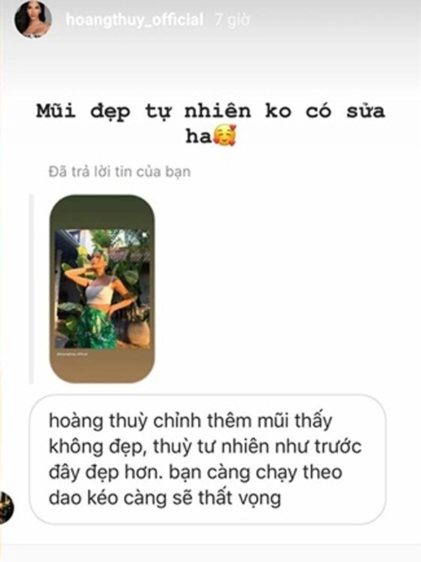 Vướng nghi vấn nâng ngực rồi sửa mũi nàng á hậu vẫn khổ sở vì bị nói đẹp nhân tạo - 14