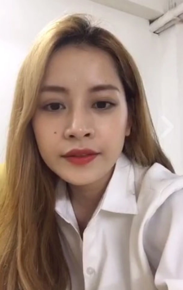 Xinh đẹp quyến rũ như chi pu vẫn phải phẫu thuật điểm này để trở nên hoàn hảo - 5