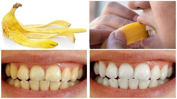 22 cách làm trắng răng tự nhiên tại nhà hiệu quả nhanh nhất - 4