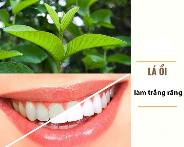 22 cách làm trắng răng tự nhiên tại nhà hiệu quả nhanh nhất - 8