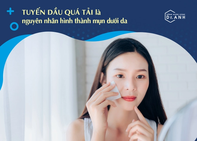 Bối rối vì mụn ẩn học ngay cách xử lý hiệu quả từ chuyên gia biodermato - 2