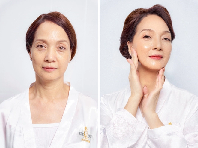Có gì đặc biệt ở bộ đôi công nghệ được phụ nữ giới thượng lưu ưa chuộng - 2