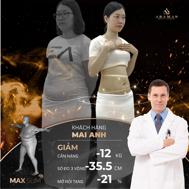 Giảm béo tại adamas và những màn lột xác đổi đời - 4
