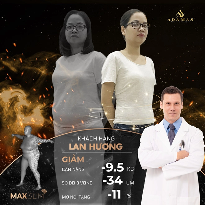 Giảm béo tại adamas và những màn lột xác đổi đời - 5