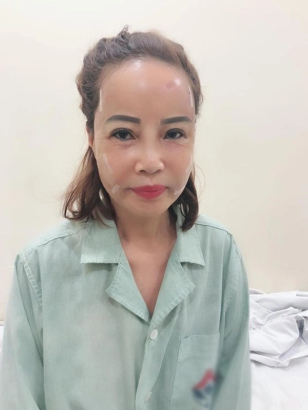 Hai hiện tượng mạng xã hội nổi tiếng với câu chuyện dao kéo liệu đâu là điểm dừng - 2