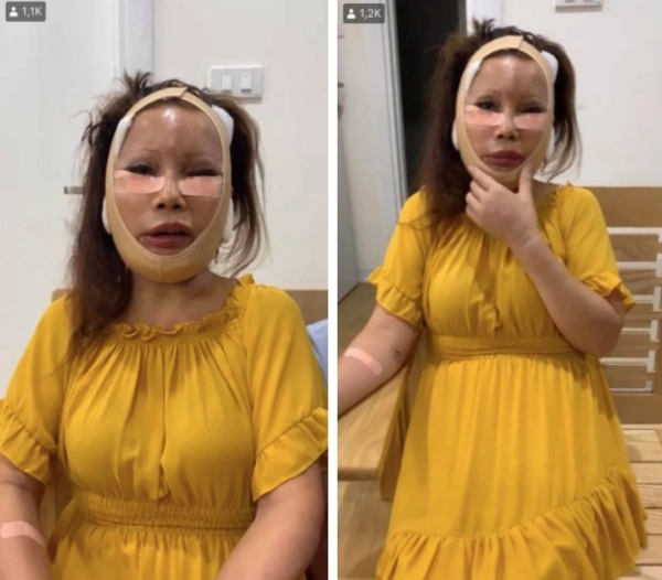 Hai hiện tượng mạng xã hội nổi tiếng với câu chuyện dao kéo liệu đâu là điểm dừng - 3