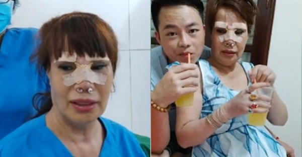 Hai hiện tượng mạng xã hội nổi tiếng với câu chuyện dao kéo liệu đâu là điểm dừng - 5