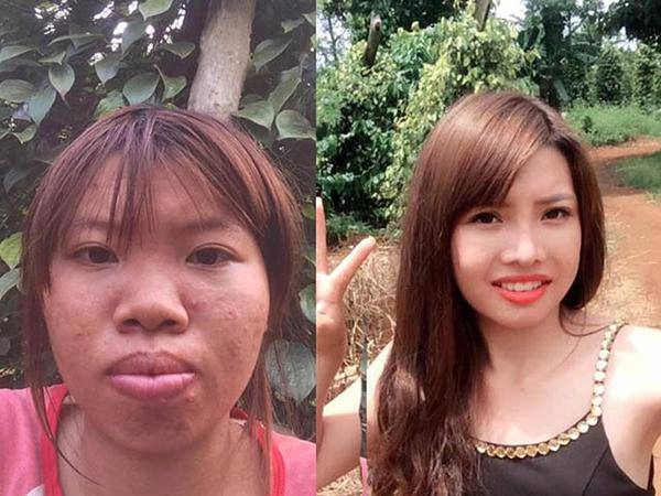 Hai hiện tượng mạng xã hội nổi tiếng với câu chuyện dao kéo liệu đâu là điểm dừng - 10